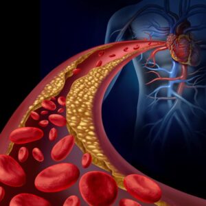 diagrama de cuerpo, con corazón y colesterol