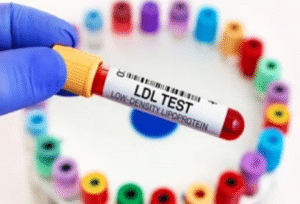 tubo de prueba de sangre ldl