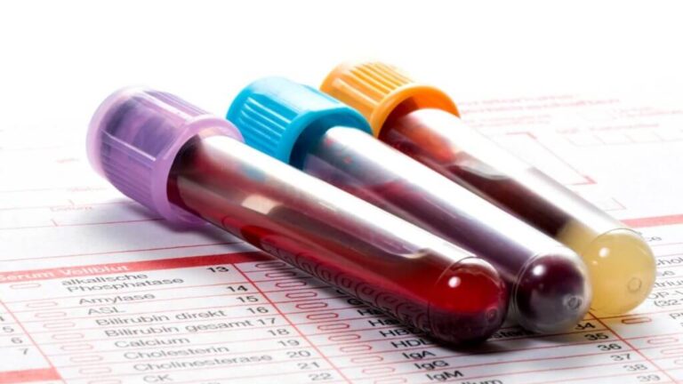 Datos curiosos sobre la sangre